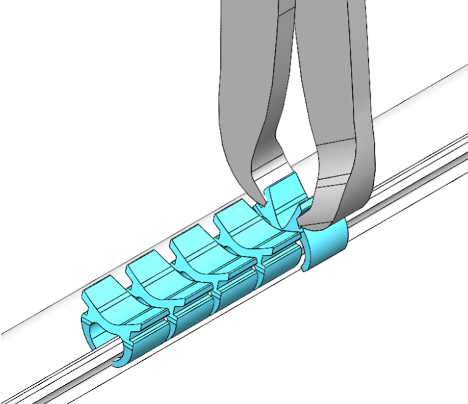 NeuraMedica Inc. Receives FDA 510(k) Clearance for DuraFuse Dural Clips for Fast & Secure Dural Closur